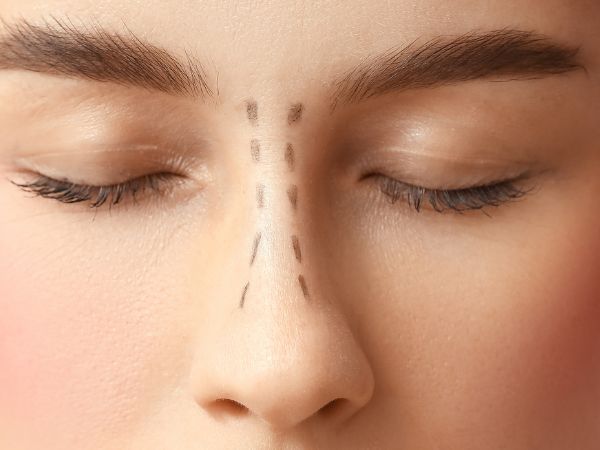 Septorhinoplasty Mumbai – Dr. Saumil Shah